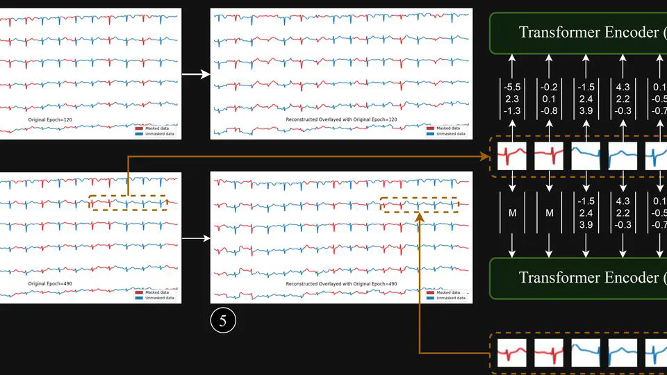 Toward Robust Automated Cardiovascular Arrhythmia Detection using Self-supervised Learning and 1-Dimensional Vision Transformers
