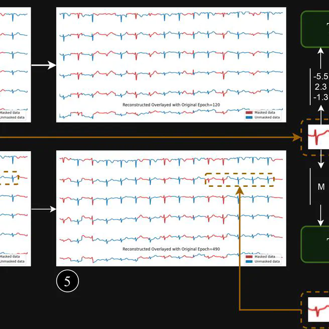 Toward Robust Automated Cardiovascular Arrhythmia Detection using Self-supervised Learning and 1-Dimensional Vision Transformers